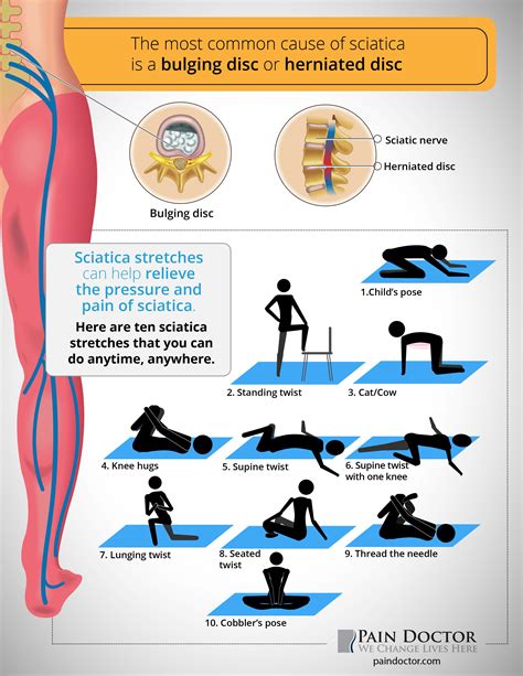 Jan 2, 2020 ... If you have a desk job, get up every 30 minutes to an hour and walk a short distance. ... See Sciatica Exercises for Sciatica Pain Relief.